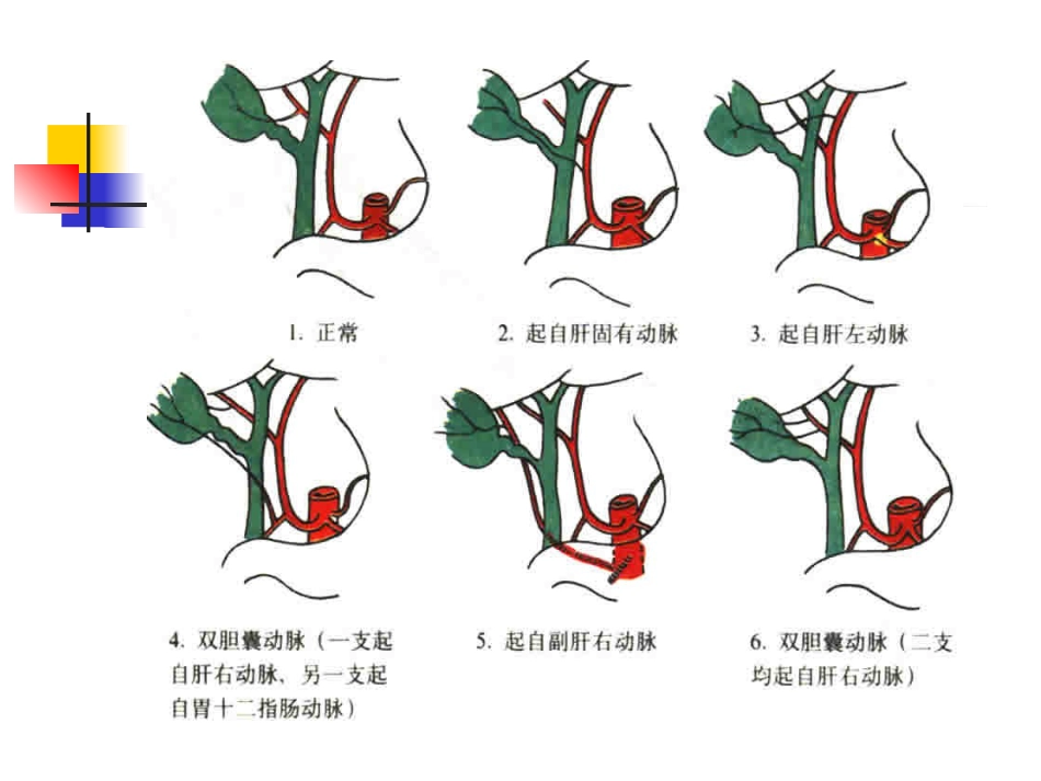 胆囊炎、胆石症课件_第9页
