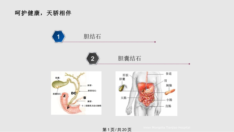 胆结石与胆囊结石PPT课件_第1页