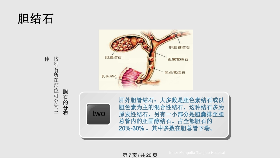胆结石与胆囊结石PPT课件_第7页