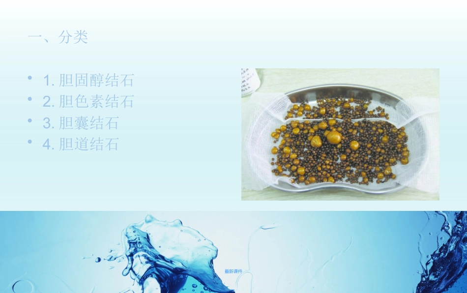 胆结石疾病教程_第2页