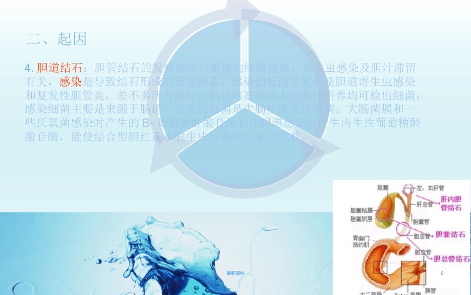 胆结石疾病教程_第6页