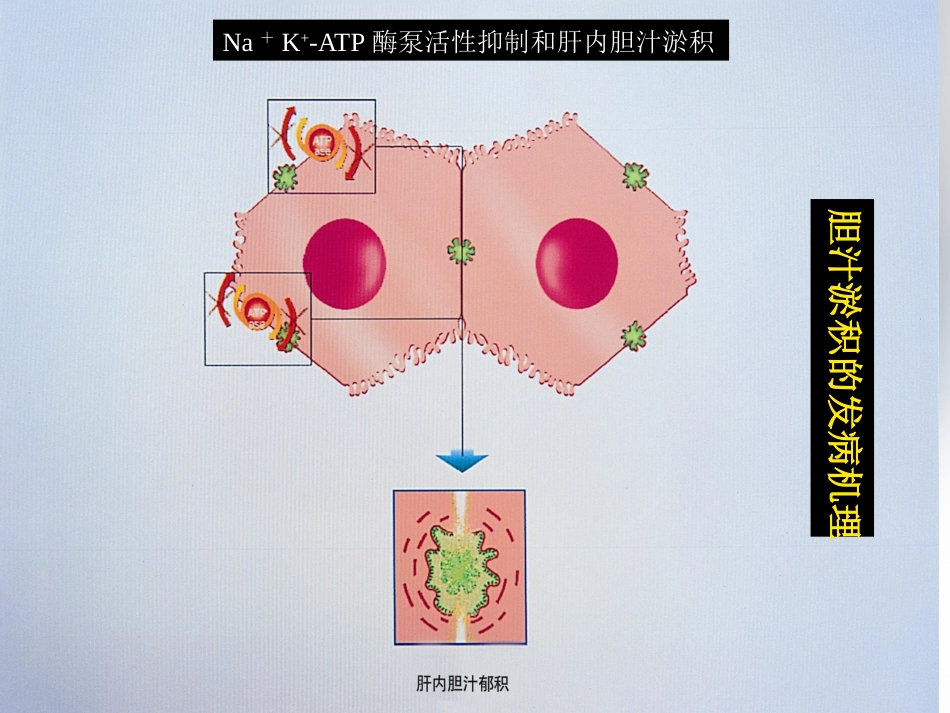 胆汁淤积性肝病介绍_第13页