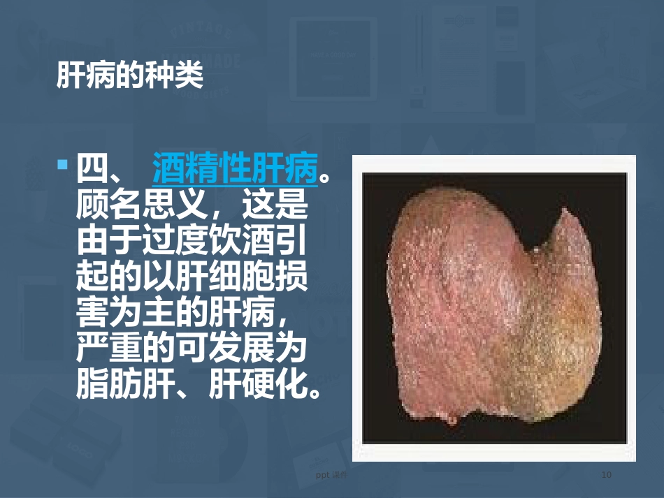 常见肝病成因与防治 ppt课件_第10页