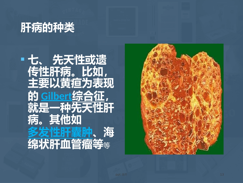 常见肝病成因与防治 ppt课件_第13页