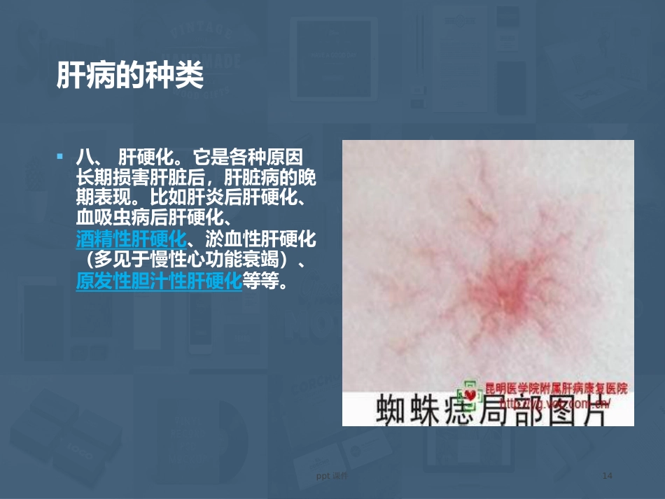 常见肝病成因与防治 ppt课件_第14页