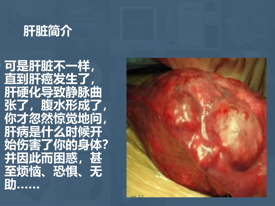 常见肝病成因与防治 ppt课件_第6页
