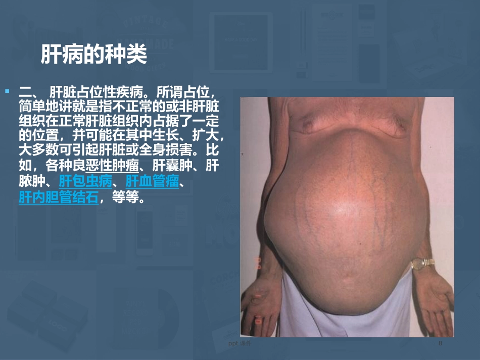 常见肝病成因与防治 ppt课件_第8页