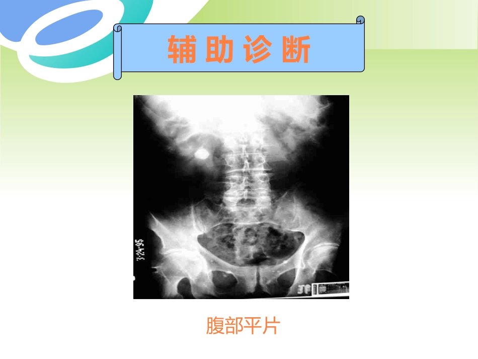 胆囊疾病及防治PPT课件_第10页