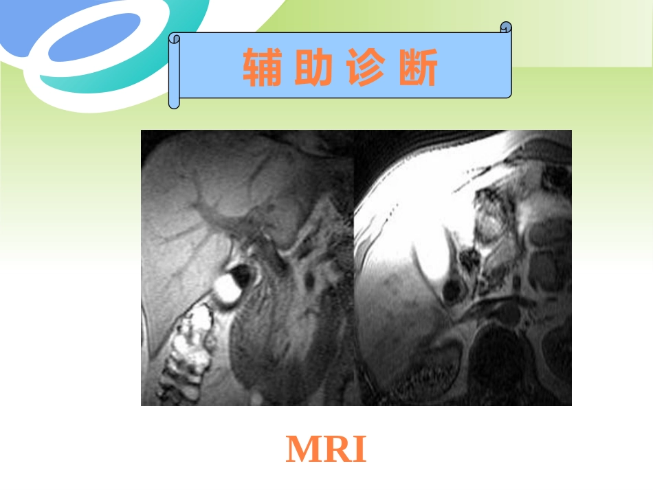 胆囊疾病及防治PPT课件_第13页