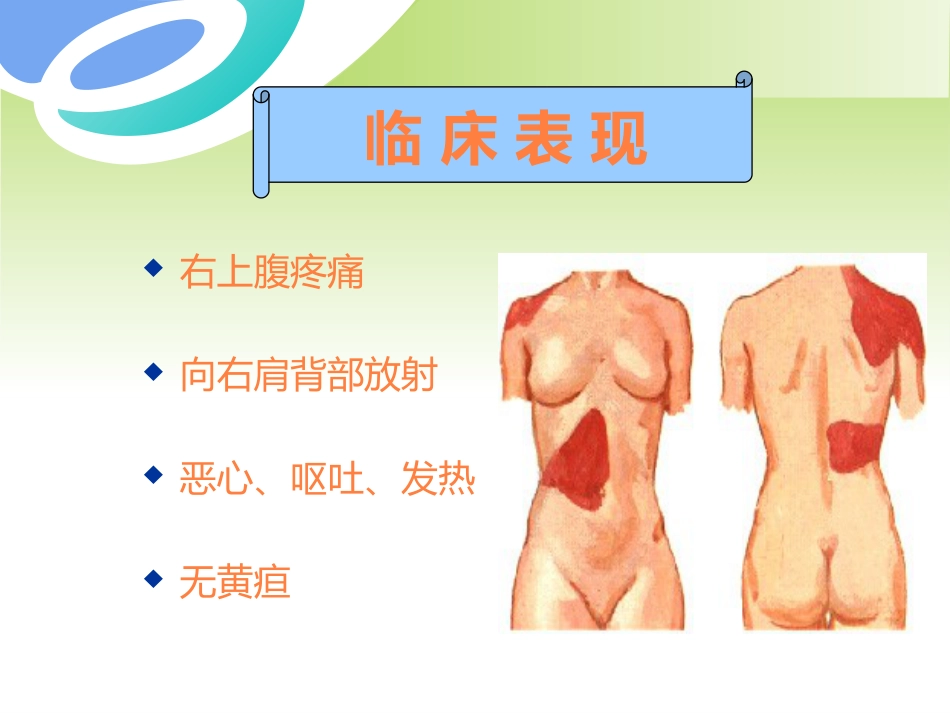胆囊疾病及防治PPT课件_第7页