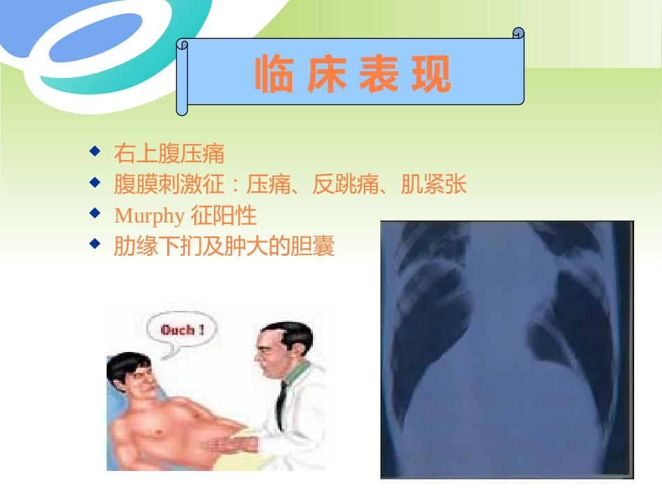 胆囊疾病及防治PPT课件_第8页
