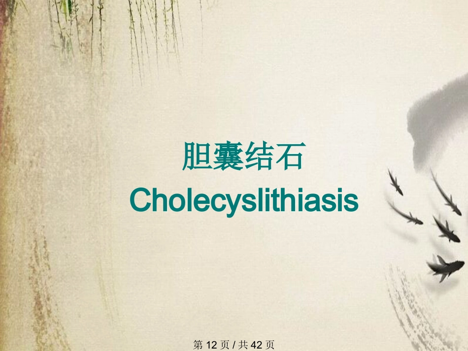 胆石症课件_第12页