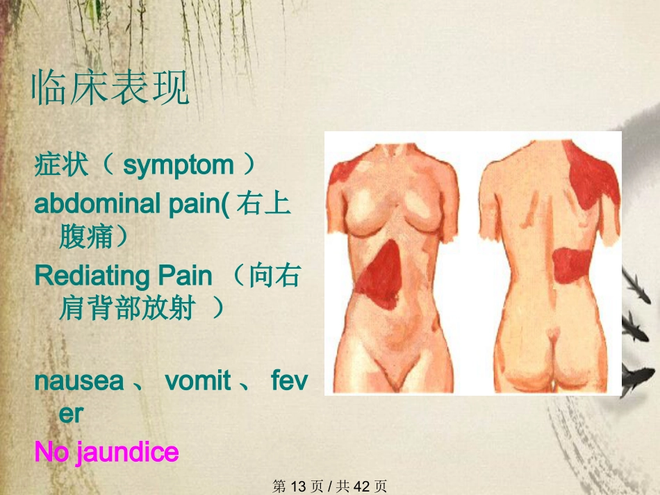 胆石症课件_第13页