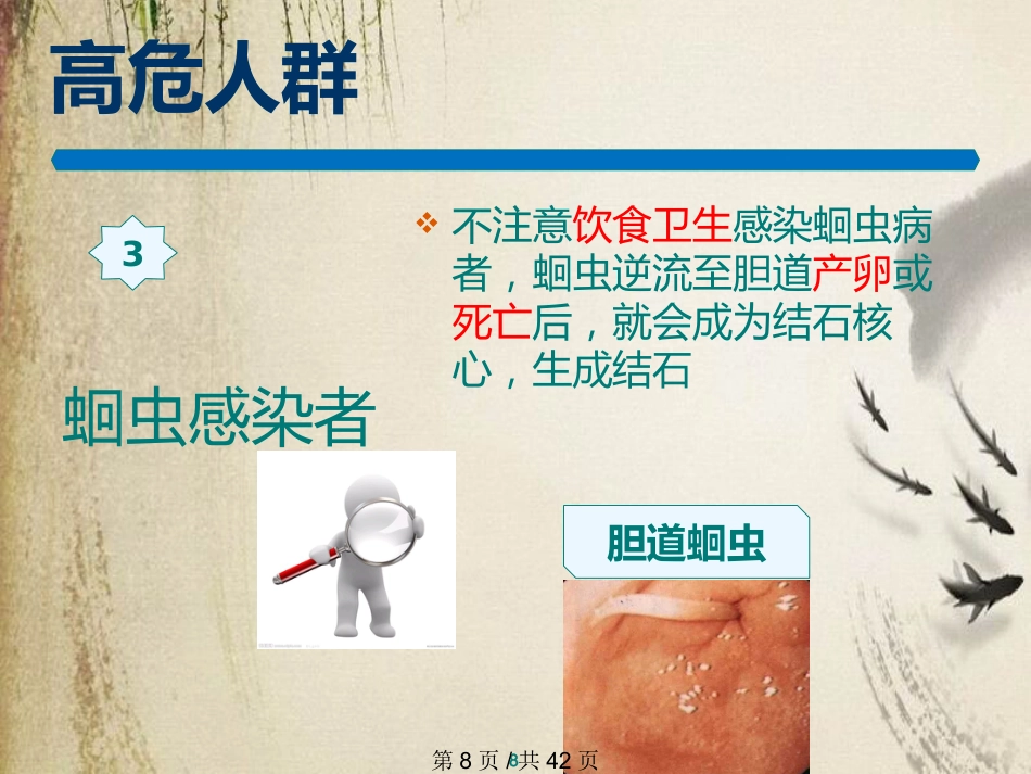 胆石症课件_第8页