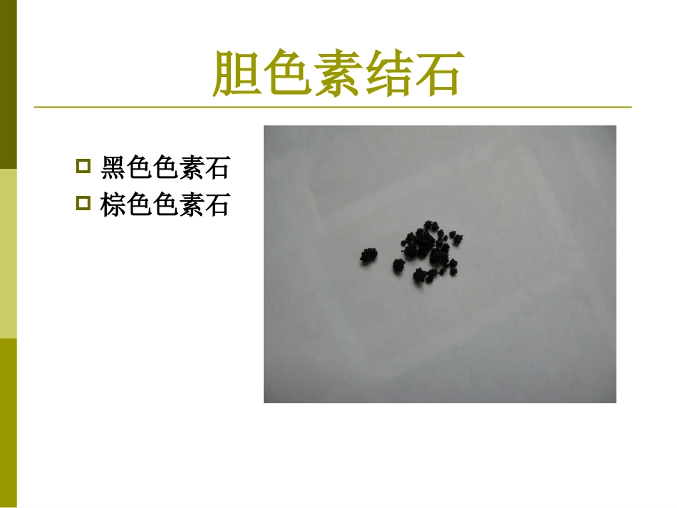 胆囊结石成因和治疗进展PPT课件_第15页