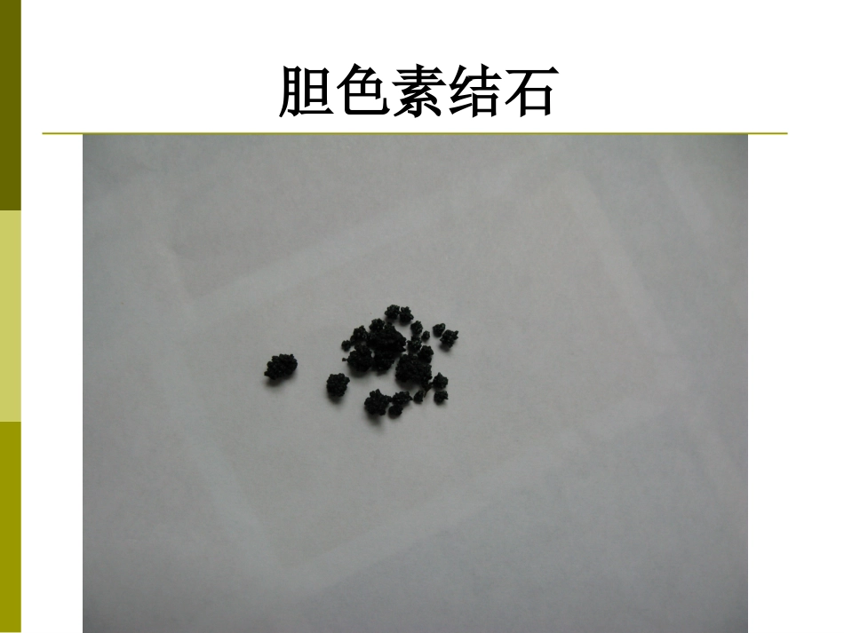 胆囊结石成因和治疗进展PPT课件_第8页