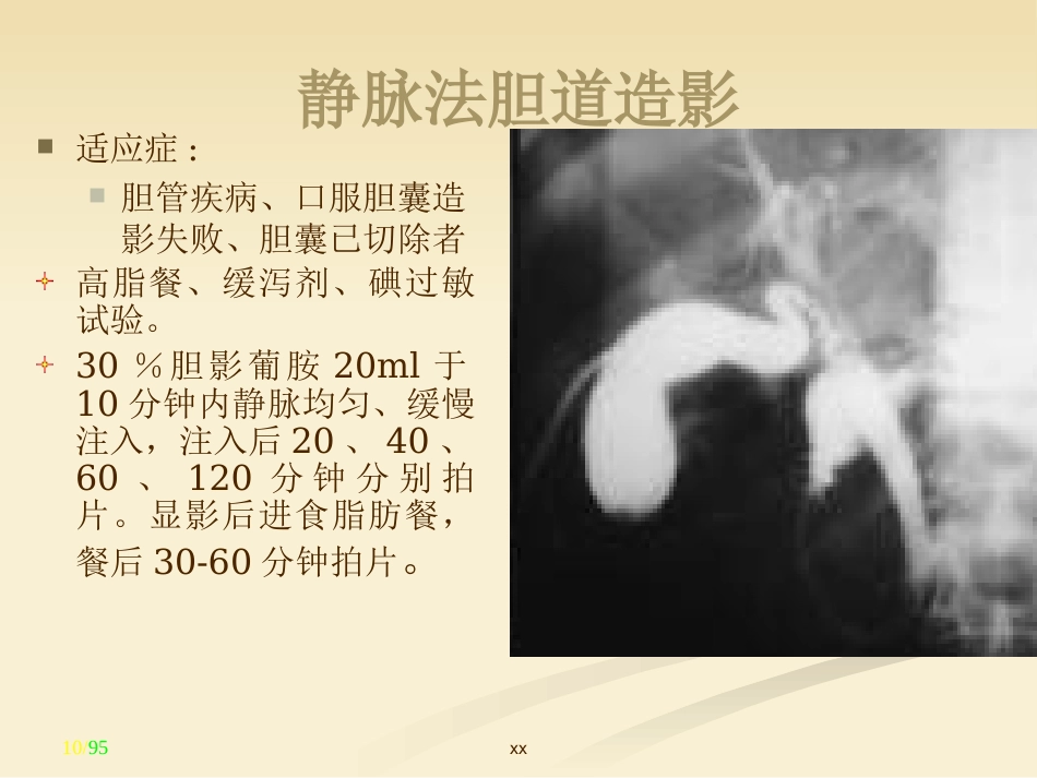 胆道外科_第10页