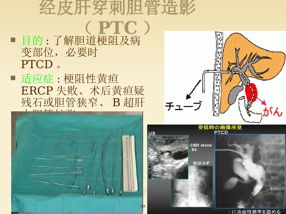 胆道外科_第11页