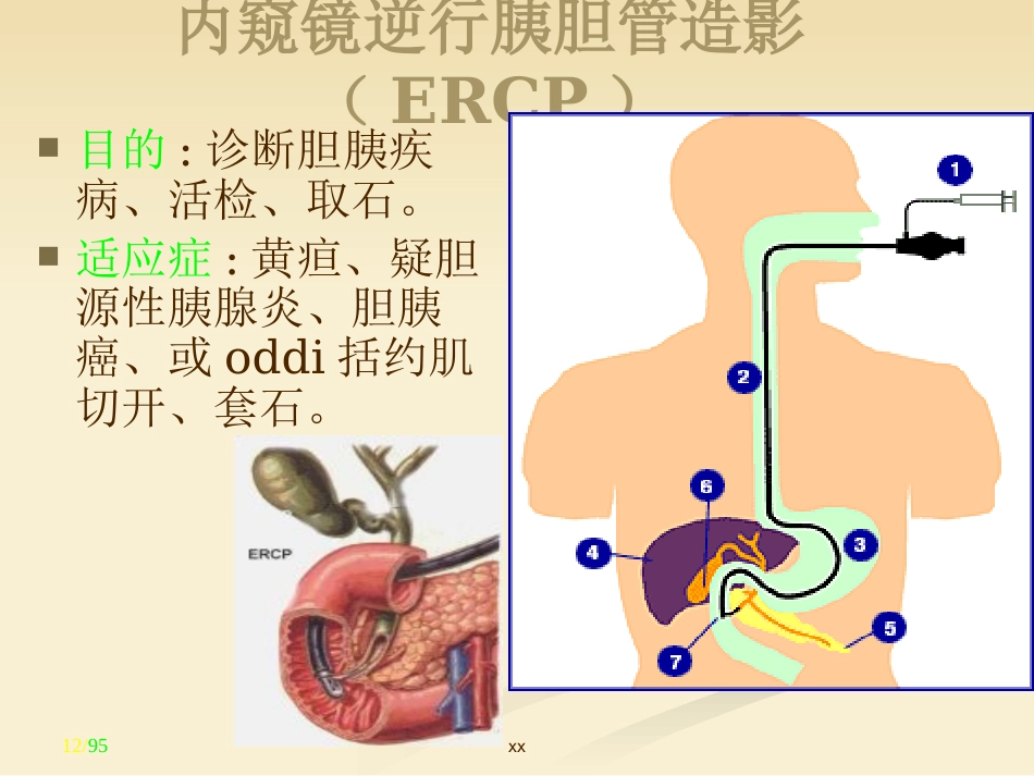 胆道外科_第12页