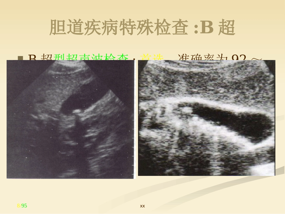 胆道外科_第8页