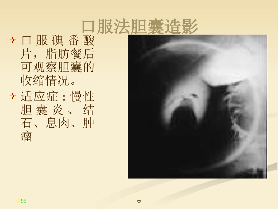 胆道外科_第9页