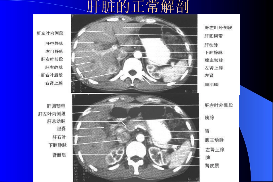 MR在肝脏病变诊断中应用_第3页