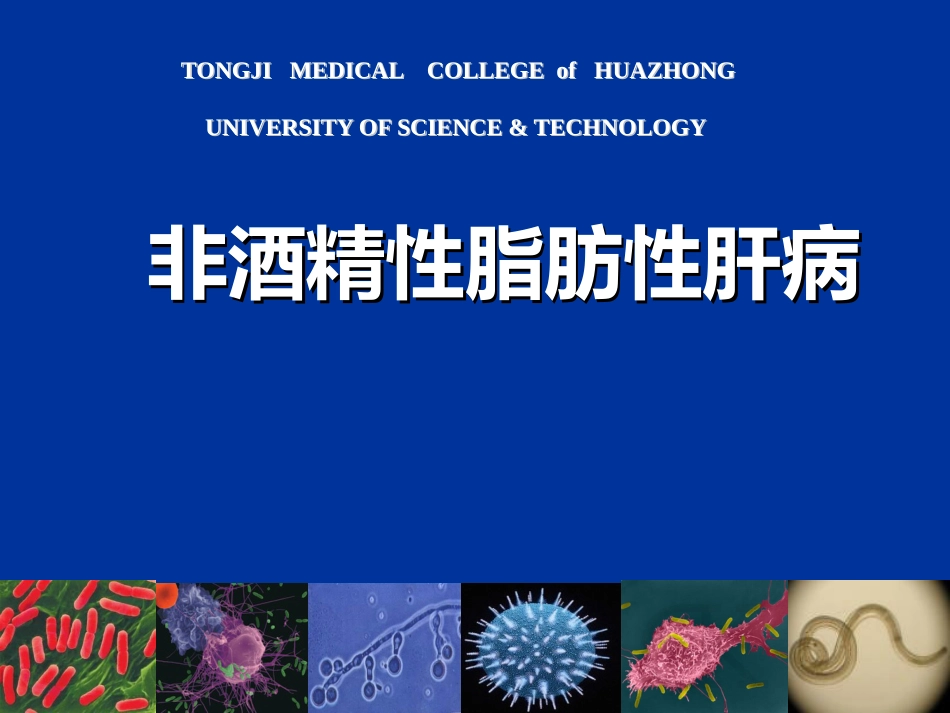 非酒精性脂肪性肝病汇总_第1页