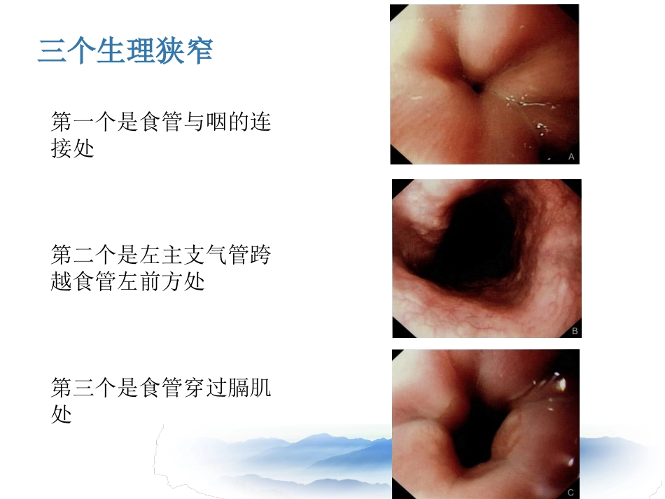 常见消化系统疾病的内镜诊断_第4页