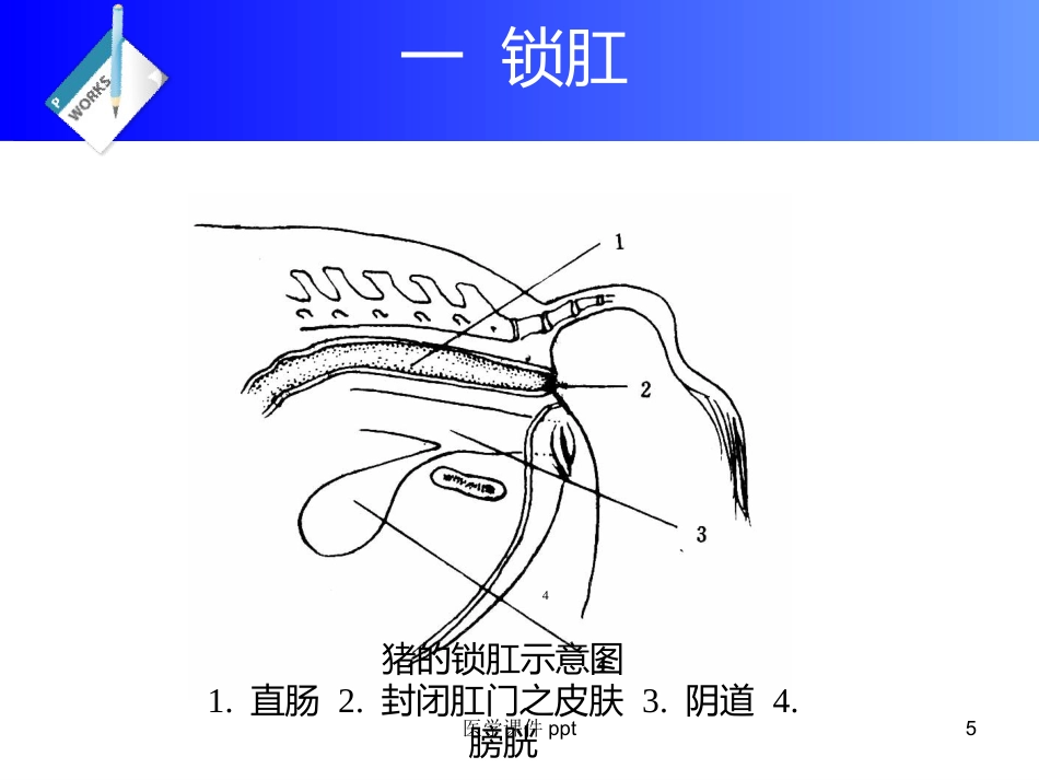 《直肠及肛门疾病》PPT课件_第5页