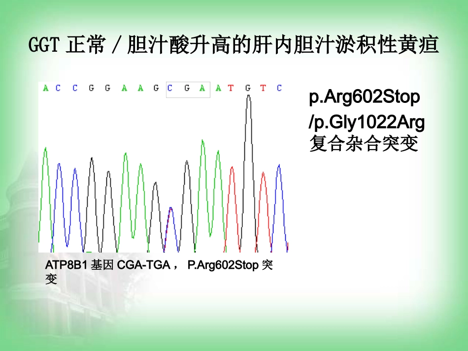 不明原因肝病(病例分享)_第15页