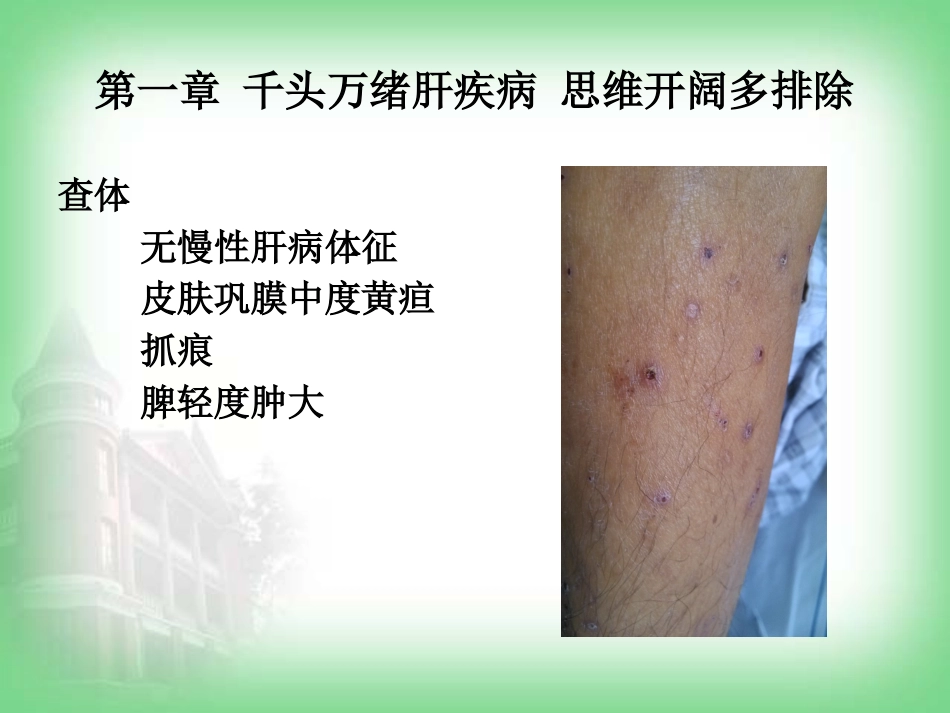 不明原因肝病(病例分享)_第5页