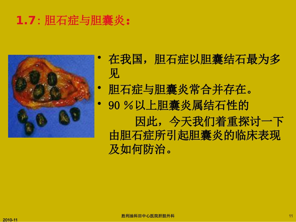 胆囊炎与胆石症ppt_第11页