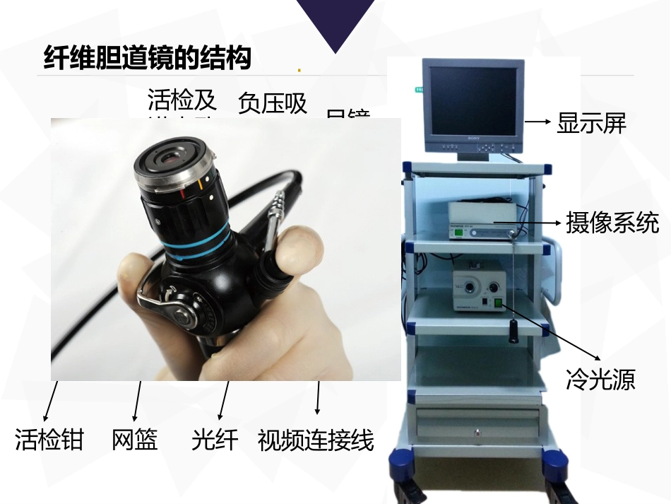 胆道镜课件_第15页
