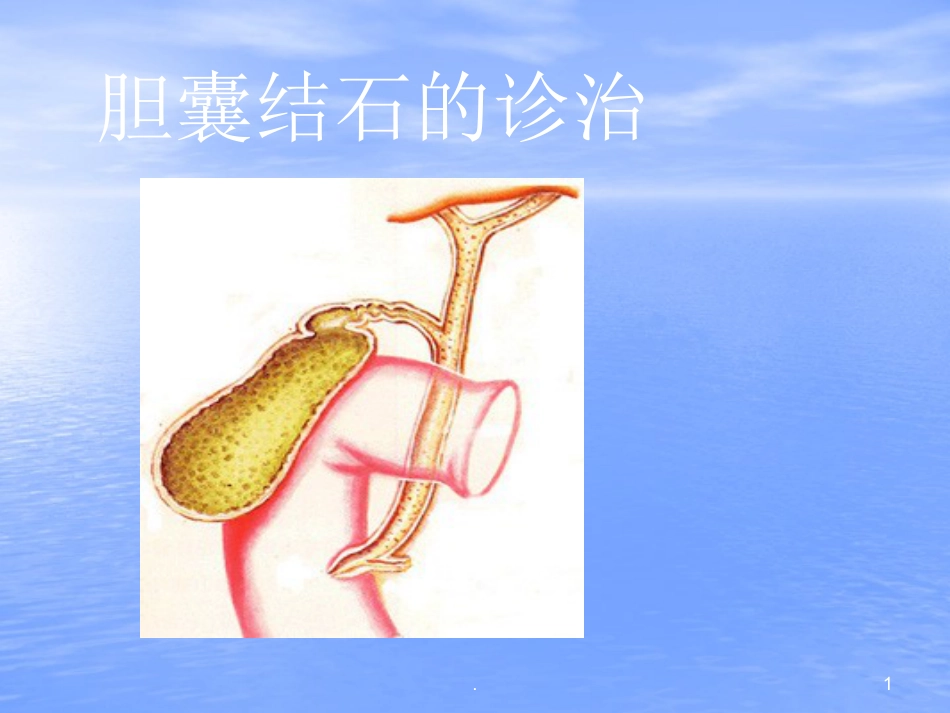 胆结石PPT幻灯片_第1页