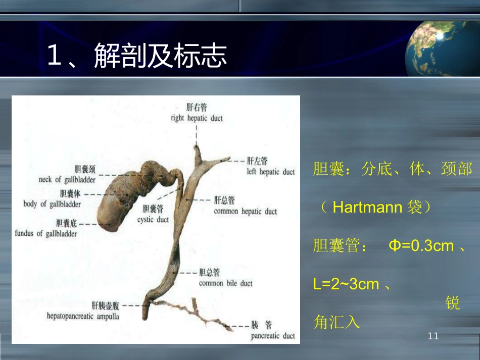 LC之胆道损伤并发症ppt课件_第11页