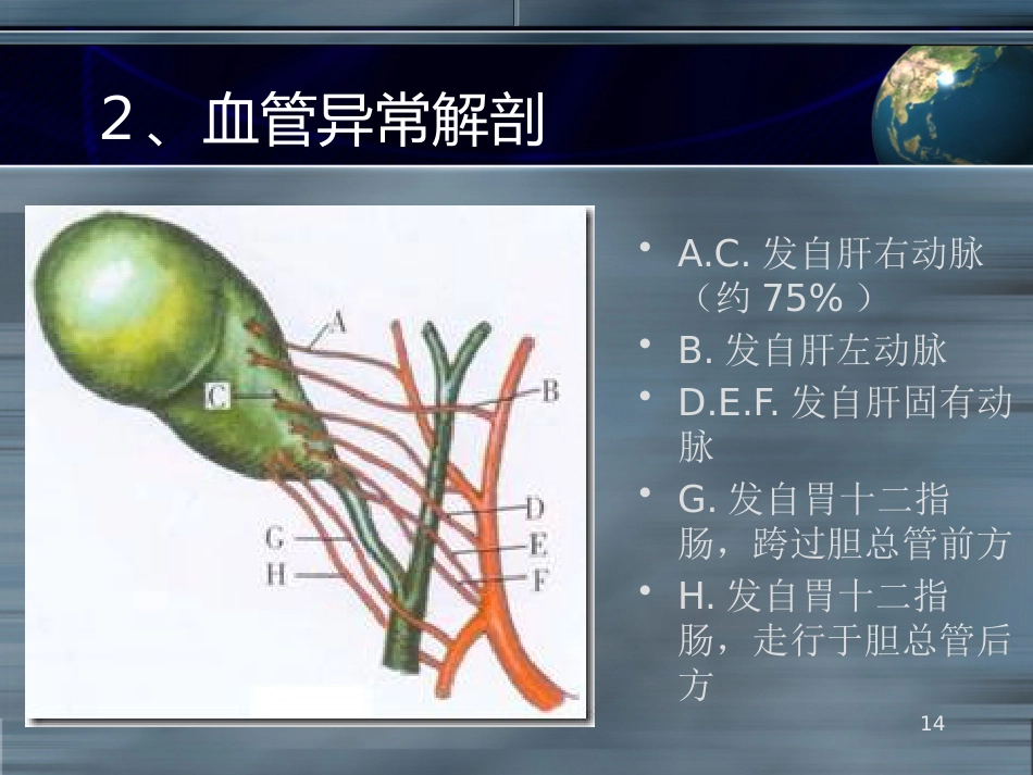 LC之胆道损伤并发症ppt课件_第14页