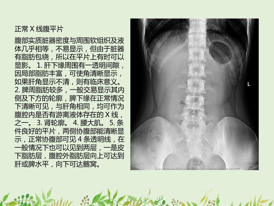 如何观察腹部X线平片-——腹部X线平片常见病的诊断_第3页