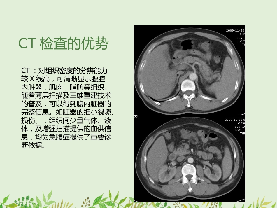 如何观察腹部X线平片-——腹部X线平片常见病的诊断_第7页