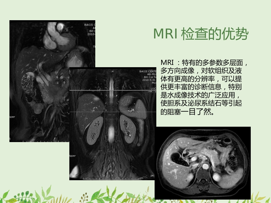 如何观察腹部X线平片-——腹部X线平片常见病的诊断_第9页