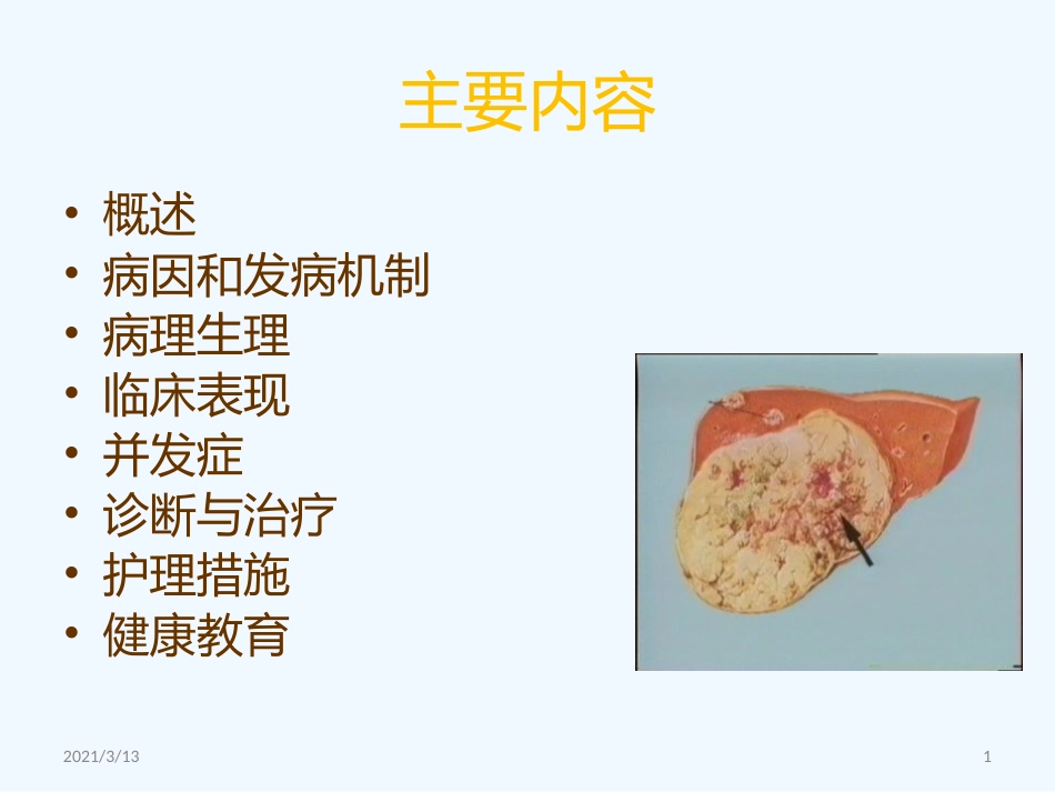读书报告原发性肝癌_第1页
