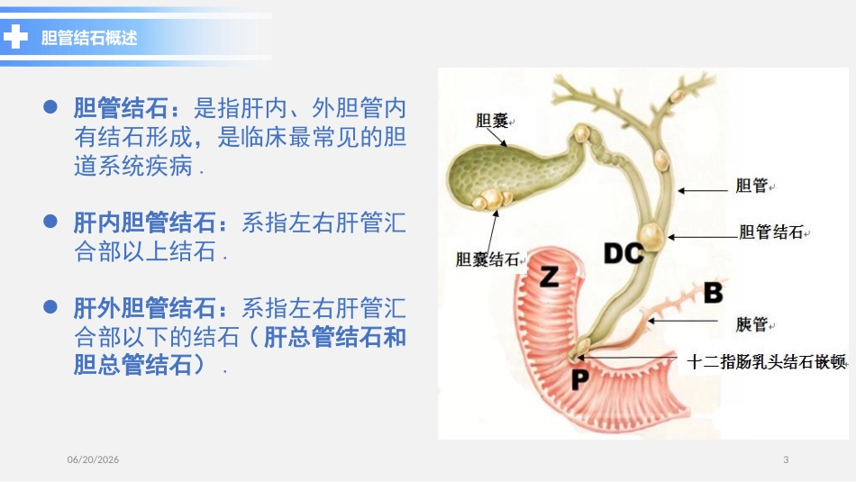 胆总管结石PPT参考课件_第3页