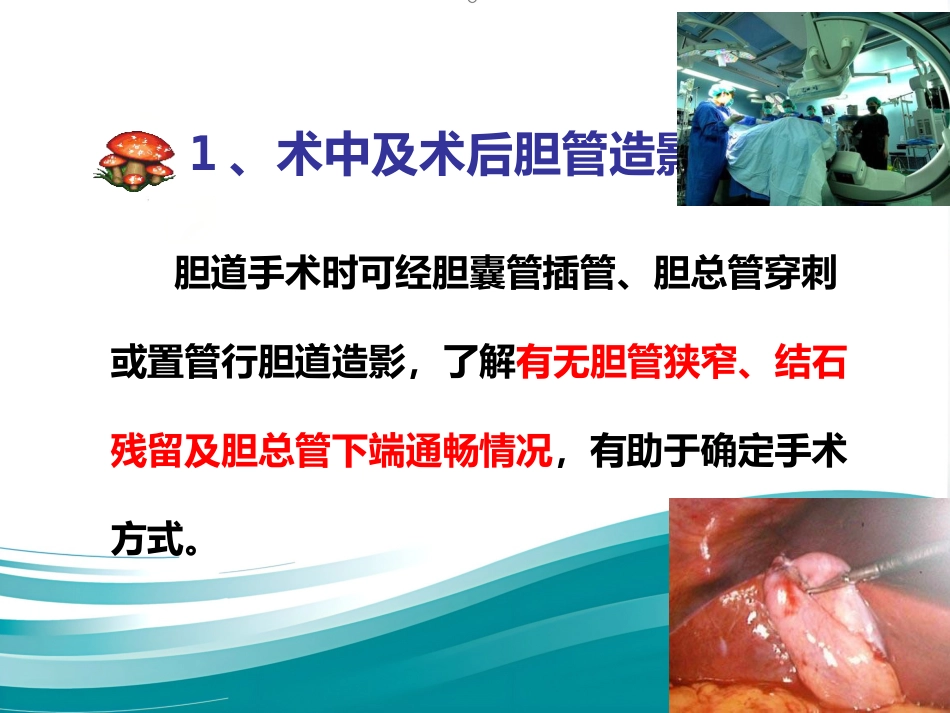 胆道系统疾病检查_第11页