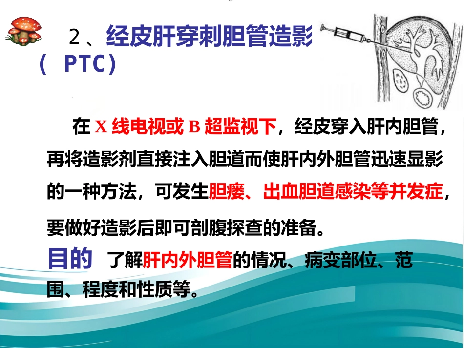 胆道系统疾病检查_第15页