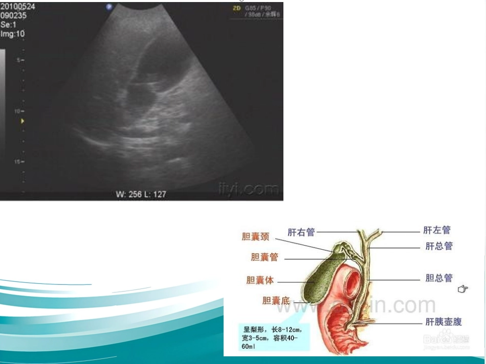 胆道系统疾病检查_第7页