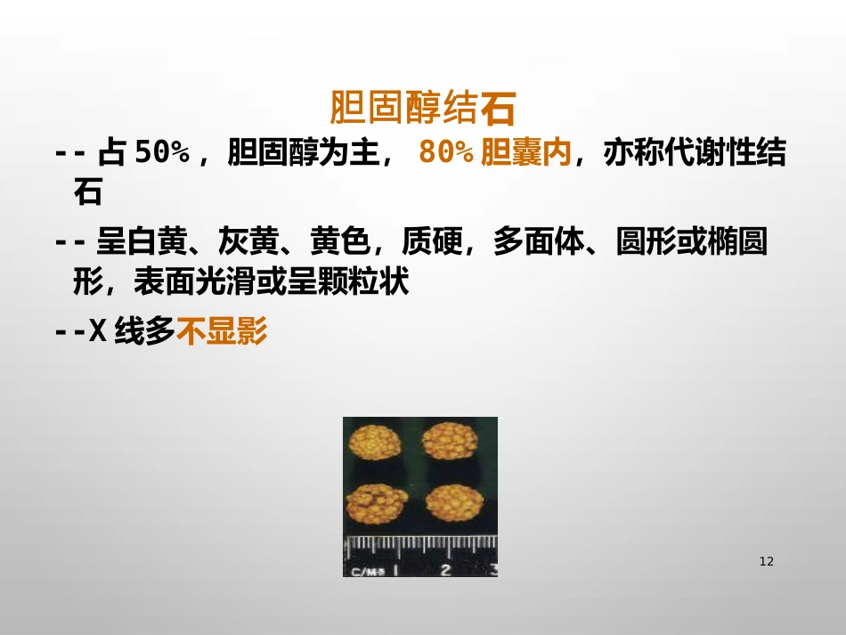 胆结石的诊治_第12页
