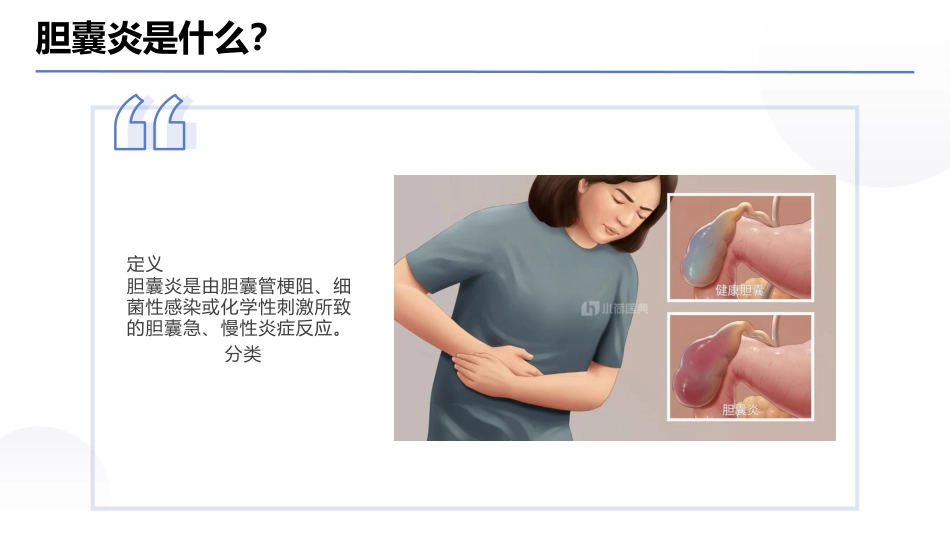 胆囊炎 PPT课件_第3页