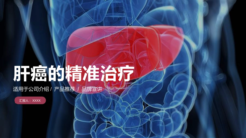 PPT案例-肝癌的精准治疗_第1页