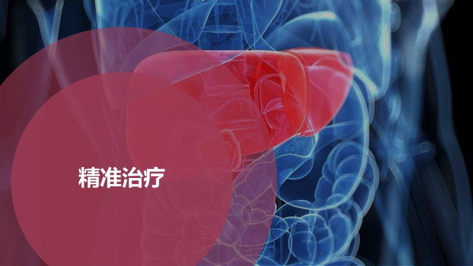 PPT案例-肝癌的精准治疗_第11页