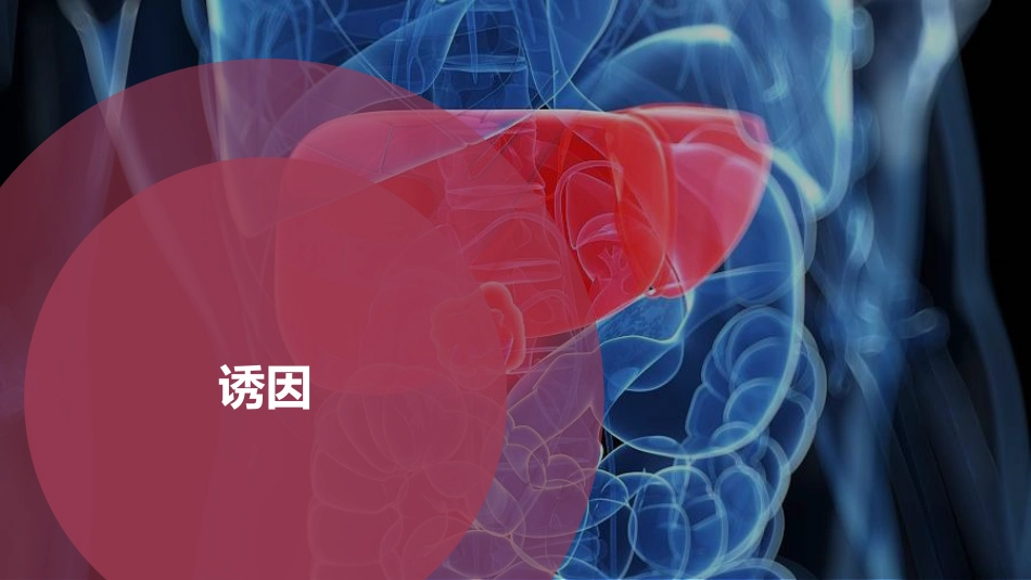 PPT案例-肝癌的精准治疗_第6页