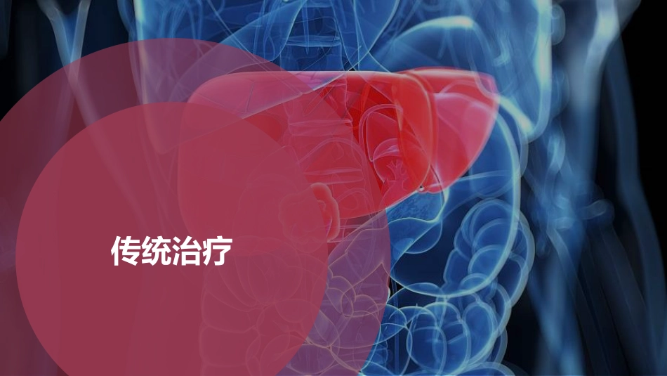 PPT案例-肝癌的精准治疗_第9页